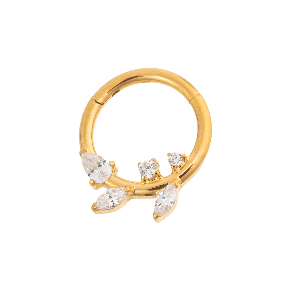 Segmentring mit Zirkonia – Ast-Design