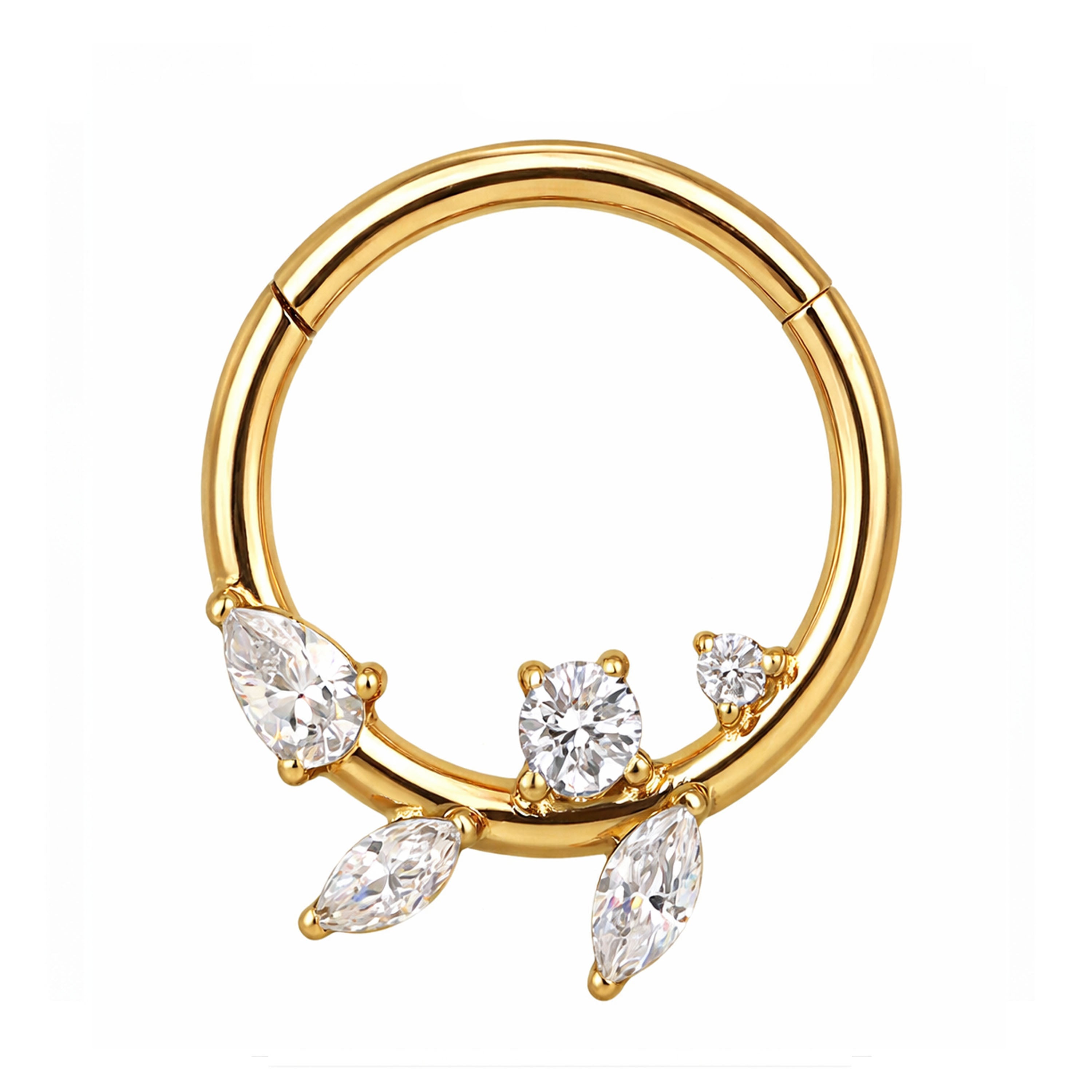 Segmentring mit Zirkonia – Ast-Design